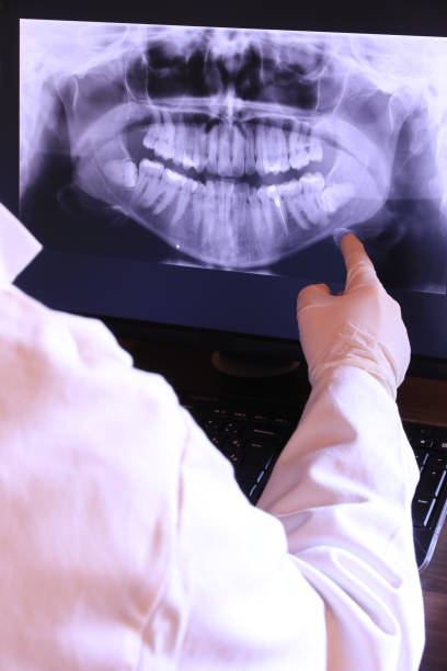 Best Emergency Dental Surgery in Dilworth, MN