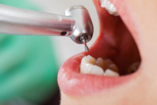 Best Emergency Treatment for Toothache in Dilworth, MN